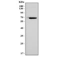 Western blot testing of mouse heart tissue lysate with Msln antibody. Predicted molecular weight ~69 kDa.