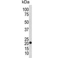 Western blot testing of human SK-BR-3 cell lysate with TAGLN antibody. Predicted molecular weight ~22 kDa.