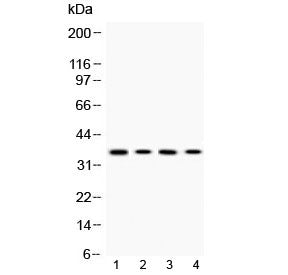 Western blot testing of 1) rat PC12, 2) mouse Hepa1-6, 3) human HeLa and 4) human A375 cell lysate with MC1R antibody at 0.5ug/ml. Predicted molecular weight ~35 kDa.