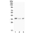 Western blot testing of 1) human COLO-320, 2) rat testis and 3) mouse Neuro-2A lysate with Galectin 8 antibody. Expected molecular weight ~36/40 kDa (isoforms 1/2).
