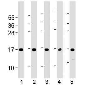 Western blot testing of human 1) 293T/17, 2) HUVEC, 3) K562, 4) NCI-H460 and 5) PC-3 cell lysate with Eotaxin-3 antibody at 1:2000. Predicted molecular weight ~11 kDa.