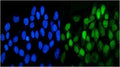Immunofluorescent co-staining of human A431 cells with DDR1 antibody (green) and DAPI nuclear stain (blue).