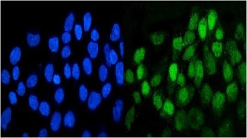 Immunofluorescent co-staining of human A431 cells with DDR1 antibody (green) and DAPI nuclear stain (blue).