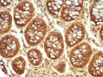 IHC staining of FFPE human colon tissue with Alpha-2-Macroglobulin antibody (clone A2M/6550). HIER: boil tissue sections in pH 9 10mM Tris with 1mM EDTA for 20 min and allow to cool before testing.