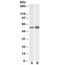 Western blot testing of human [A] and mouse [B] brain lysate with GDH antibody at 0.03ug/ml. Predicted molecular weight ~61kDa.