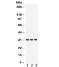 Western blot testing of 1) rat liver, 2) mouse liver and 3) human SMMC lysate with VDAC antibody. Expected/observed molecular weight ~31 kDa.