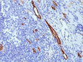 IHC: Formalin-fixed, paraffin-embedded human tonsil stained with anti-von Willebrand Factor antibody (clone SPM577).