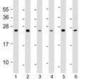 Western blot testing of 1) A549, 2) HCT116, 3) MCF-7, 4) NCI-H1299, 5) Raji and 6) THP-1 cell lysate with TPD52 antibody at 1:2000. Expected molecular weight: 20~26 kDa (isoforms 1-7).