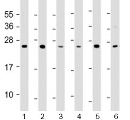 Western blot testing of 1) A549, 2) HCT116, 3) MCF-7, 4) NCI-H1299, 5) Raji and 6) THP-1 cell lysate with TPD52 antibody at 1:2000. Expected molecular weight: 20~26 kDa (isoforms 1-7).