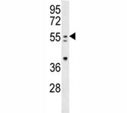PAX-7 antibody western blot analysis in mouse spleen tissue lysate. Expected molecular weight: 55-57 kDa.