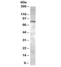 Western blot testing of Jurkat lysate with ACAP1 antibody at 0.5ug/ml. Predicted molecular weight: ~81kDa.