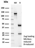 SDS-PAGE analysis of purified, BSA-free MSA antibody (clone MSA/8949R) as confirmation of integrity and purity.