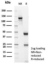 SDS-PAGE analysis of purified, BSA-free MSA antibody (clone MSA/8949R) as confirmation of integrity and purity.