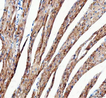 IHC staining of FFPE mouse heart tissue with Mitofilin antibody. HIER: boil tissue sections in pH8 EDTA for 20 min and allow to cool before testing.