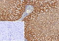 IHC staining of FFPE human liver tissue with Alpha-2-Macroglobulin antibody (clone A2M/6553). Inset: PBS used in place of primary Ab (secondary Ab negative control). HIER: boil tissue sections in pH 9 10mM Tris with 1mM EDTA for 20 min and allow to cool before testing.