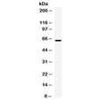 Western blot testing of human HepG2 cell lysate with Carboxypeptidase M antibody at 0.5ug/ml. Expected molecular weight: 51-65 kDa depending on glycosylation level.