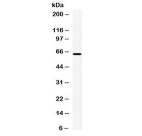 Western blot testing of human HepG2 cell lysate with Carboxypeptidase M antibody at 0.5ug/ml. Expected molecular weight: 51-65 kDa depending on glycosylation level.