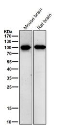 All lanes use the Phospho-Beta Catenin (Thr41/Ser45) antibody at 1:1K dilution for 1 hour at room temperature.