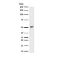 Western blot testing of human HeLa cell lysate with recombinant Cytokeratin 7 antibody (clone CTKN7-2R). Predicted molecular weight ~51 kDa.