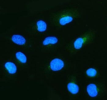 Immunofluorescent staining of NUDT9 using anti-NUDT9 antibody (green). NUDT9 was detected in an immunocytochemical section of cells. Enzyme antigen retrieval was performed using IHC enzyme antigen retrieval reagent for 15 mins. The cells were blocked with 10% goat serum. And then incubated with 5 ug/ml rabbit anti-NUDT9 antibody overnight at 4oC. DyLight 488 Conjugated Goat Anti-Rabbit IgG was used as secondary antibody at 1:500 dilution and incubated for 30 min at 37oC.