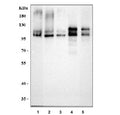 Western blot testing of 1) human SH-SY5Y, 2) human HepG2, 3) human HeLa, 4) rat brain and 5) mouse brain tissue lysate with APLP2 antibody. Predicted molecular weight ~87 kDa, the glycosylated full length and truncated form can be observed at ~120 kDa and ~95 kDa, the CS-GAG modified form can be observed at 130-170 kDa and homodimers and heterodimers may be observed at over 200 kDa.