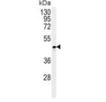 Western blot testing of human T-47D cell lysate with ADH1C antibody. Predicted molecular weight ~40 kDa.