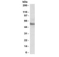 Western blot testing of human MOLT4 cell lysate with ERG antibody at 0.1ug/ml. Predicted molecular weight ~54 kDa.