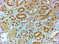 IHC testing of FFPE human kidney with DMRT2 antibody at 2ug/ml. HIER: steamed with pH6 citrate buffer, HRP-staining.