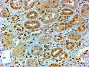 IHC testing of FFPE human kidney with DMRT2 antibody at 2ug/ml. HIER: steamed with pH6 citrate buffer, HRP-staining.