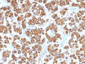IHC testing of FFPE human pituitary gland with GH antibody (clone GH/1450). Required HIER: boil tissue sections in pH 9 10mM Tris with 1mM EDTA for 10-20 min.
