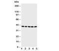 Western blot testing of BCAT2 antibody and Lane 1: A431; 2: SW620; 3: SMMC-7721; 4: Jurkat; 5: CEM cell lysate