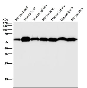 All lanes use the KLC3 antibody at 1:2K dilution for 1 hour at room temperature. Predicted molecular weight ~55 kDa.