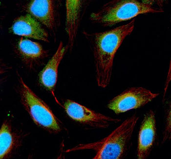 Immunofluorescent staining of ESD using anti-ESD antibody (green) and anti-Beta Tubulin antibody (red). ESD was detected in an immunocytochemical section of U2OS cells. Enzyme antigen retrieval was performed using IHC enzyme antigen retrieval reagent for 15 mins. The cells were blocked with 10% goat serum. And then incubated with 5 ug/ml rabbit anti-ESD antibody and mouse anti-Beta Tubulin antibody overnight at 4oC.