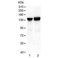 Western blot testing of 1) rat liver and 2) mouse liver lysate with Collagen II antibody at 0.5ug/ml. Predicted molecular weight ~140 kDa.