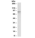 Western blot testing of rat kidney lysate with HCN3 antibody at 1ug/ml. Predicted molecular weight: ~86kDa.