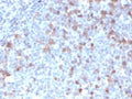 IHC testing of FFPE human tonsil with Cdc20 antibody (clone CLDC20-1). FFPE testing requires sections to be boiled in pH 9 10mM Tris with 1mM EDTA for 10-20 minutes, followed by cooling at RT for 20 minutes, prior to staining.