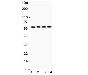 Western blot testing of FOXO1 antibody and Lane 1: rat lung; 2: (r) brain; 3: human COLO320; 4: (h) HEPG2. Predicted molecular weight: ~70kDa