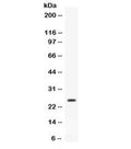 Western blot testing of mouse liver lysate with Apolipoprotein A I antibody. Predicted molecular weight ~30 kDa.