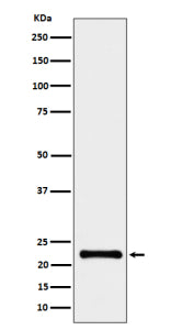 Western blot analysis of CRCP expression in human HeLa cell lysate using the CRCP antibody. A single band is detected at ~ 22-23 kDa, higher than the predicted 16 kDa MW. This migration pattern is consistent with published data showing that CRCP commonly runs near 20-23 kDa due to its acidic composition, partial membrane association, and post-translational modifications such as phosphorylation and N-terminal acetylation. The observed band therefore represents the mature functional form of CRCP.