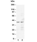 Western blot testing of CCR5 antibody and human Lane 1: Jurkat; 2: COLO320 cell lysate. Predicted/observed molecular weight ~41 kDa.