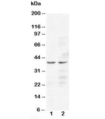 Western blot testing of CCR5 antibody and human Lane 1: Jurkat; 2: COLO320 cell lysate. Predicted/observed molecular weight ~41 kDa.