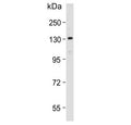 Western blot testing of human HepG2 cell lysate with POLG antibody. Predicted molecular weight ~140 kDa.