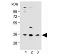 Western blot testing of human 1) LNCaP, 2) PC-3 and 3) HEK293 cell lysate with OR6C3 antibody at 1:1000 dilution. Predicted molecular weight ~35 kDa.