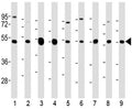 Western blot testing of mouse 1) C2C12, 2) NIH3T3, 3) brain, human 4) brain, 5) HeLa, 6) A431, 7) HEK293, 8) MCF7 and 9) rat PC-12 lysate with TUBB2A antibody at 1:2000. Predicted molecular weight ~50 kDa.