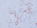 IHC staining of FFPE human gastric antrum tissue with recombinant Gastrin antibody (clone GAST/8646R). Inset: PBS used in place of primary Ab (secondary Ab negative control). HIER: boil tissue sections in pH 9 10mM Tris with 1mM EDTA for 20 min and allow to cool before testing.