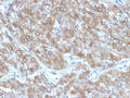 IHC staining of FFPE human adrenal gland tissue with Interleukin-2 antibody (clone IL2/4988). HIER: boil tissue sections in pH 9 10mM Tris with 1mM EDTA for 20 min and allow to cool before testing.