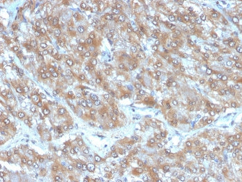 IHC staining of FFPE human adrenal gland tissue with Interleukin-2 antibody (clone IL2/4988). HIER: boil tissue sections in pH 9 10mM Tris with 1mM EDTA for 20 min and allow to cool before testing.