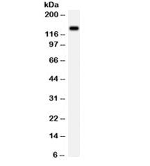 Western blot testing of rat brain lysate with NMDAR2C antibody. Expected/observed molecular weight ~134 kDa.