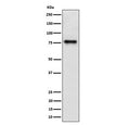 Western blot testing of human HepG2 cell lysate with TRIP10 antibody. Expected molecular weight: 40-85 kDa (multiple isoforms).