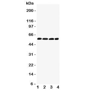 Western blot testing of IRF5 antibody and Lane 1: human placenta; 2: rat thymus; 3: (r) kidney; 4: (r) ovary tissue lysate. Expected/observed molecular weight ~57kDa.